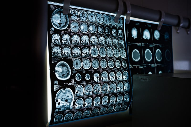Body Scan Technique